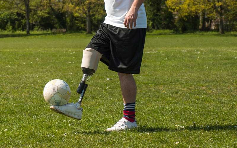 医疗器械加工:假肢CNC加工